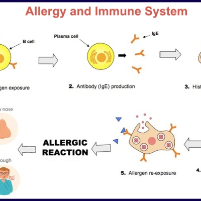 The Science Behind Food Allergies